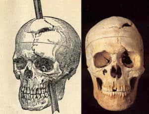The Archaeology of Brain Injury: Examples of Cases and Understanding from the Archaeological and Historical Record.